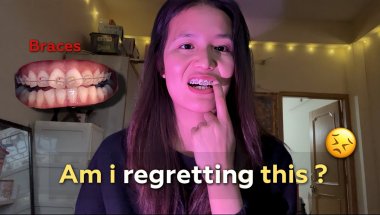 How My Braces Journey Going ? 😢 Cost, Types of braces | #vlog #bracesjourney