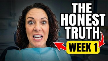 Invisalign Week 1 Reality Check | What They Don't Tell You