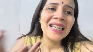 Braces lgane ke baad teeth pain hota hai?#viral #trending #dentist #comedy #youtube #toptrending