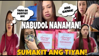 NABUDOL NANAMAN! BRACES ADJUSTMENT! SUMAKIT ANG TIYAN KO! LIKE SHARE AND SUBSCRIBE! Abengvlogs