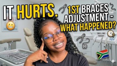 🇿🇦1st BRACES adjustment| Two TEETH extracted😭🦷🪥