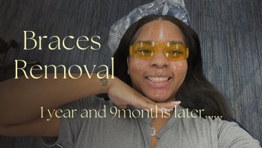 I GOT MY BRACES OFF 😭✨ (1 Year 9 Months Later… Was It Worth It?)