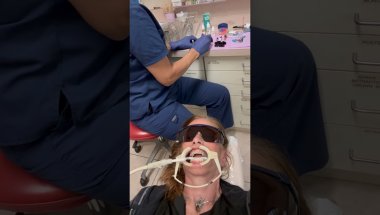 Join me as @orthomikeorthodonticstv9749 adds braces to my lower teeth #adultorthodontics