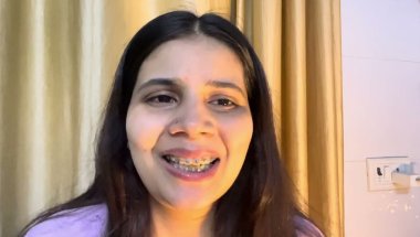Braces cost sb jagah ka alag kyu hota hai#viral #trending #dentist #teeth #youtube #toptrending