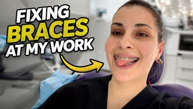 Fixing Braces at Work… But My Diet Is Ruining My Results 😭