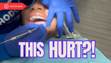 Adult Braces: First Tightening + New Color
