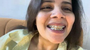 Braces lgane ke baad chale kyu ho jate hai baar baar#viral #trending #dentist #youtube #viralvideo