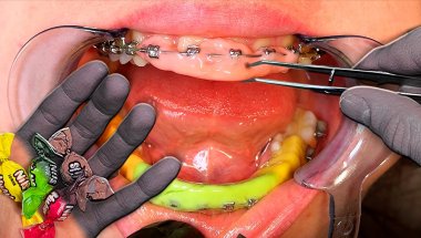 MEDITATIVE - RELAXING TEETH CLEANING