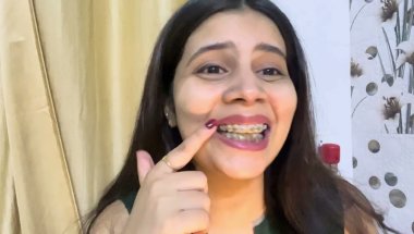 Kya braces me dry fruits kha sakte hai#viral #dentist #trending #youtube #teeth
