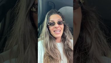 Invisalign week 3