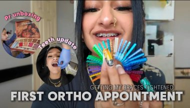 Getting my braces tighten for the first time…ouch