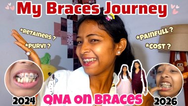 ❤️‍🩹🦷Last QnA On Braces || Last Month With Braces😕 How's Irritating Hurting Wire😭 Miss Archu vlogs