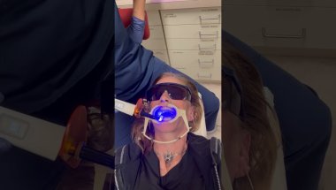 Join me as @orthomikeorthodonticstv9749 cements & secures my bottom braces! #adultorthodontics