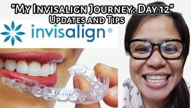 My Invisalign Journey: Day 12 |  Updates and Tips