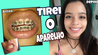 TIREI MEU APARELHO, (antes do tempo)!!!