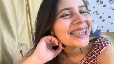 1 Year 32 days braces journey 🥲#teeth #trending #youtube #viral #viralvideo