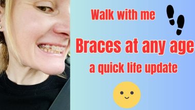 It’s Never Too Late!😁#braces #walkandtalk #dentalbraces #metalbraces #bracesjourney #smile#authentic