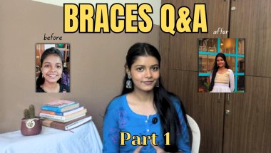 Braces Q&A Part 1: Costs, Pain, and Process (Everything You Need to Know) #braces #tamil