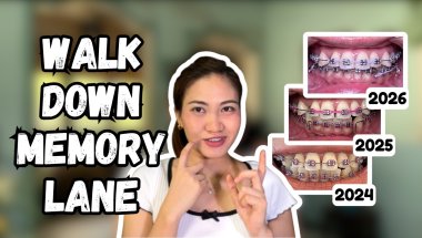 Braces Updates | Teeth Comparison | New Accessory | Addressing Comments
