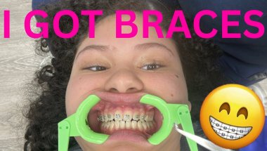 GETTING BRACES VLOG