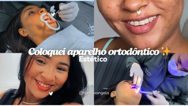 Coloquei aparelho estético ✨ #vlog #dentista #aparelhoortodôntico