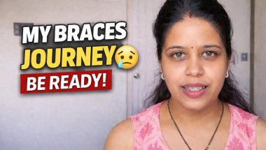 My Braces Journey 😣 Real Problems & Truth#Growthjourney#braceslife #smallyoutuber