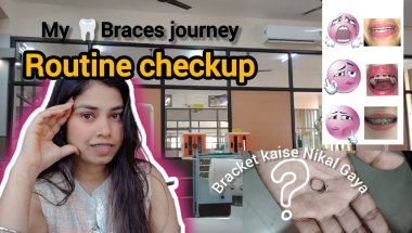 Braces journey🦷😱 pain again 🥲|| Routine checkup || Braces Update 2026@Giinuartgallery270