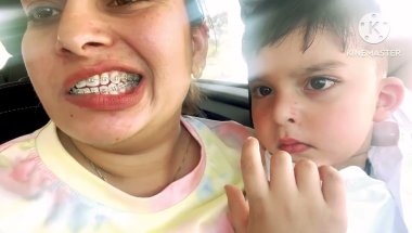 Braces nikl gye mujhe MH jana pda bhut preshan ho gyi thii ☹️