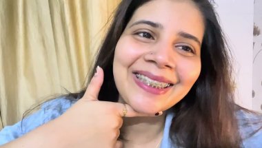 Braces lgane ke baad keisa feel hota hai#viral #dentist #trending #youtube #teeth #smiledesigndental