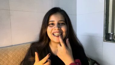 Braces lgane ka perfect age kya hota hai#viral #dentist #trending #youtube #teeth #smiledesigndental