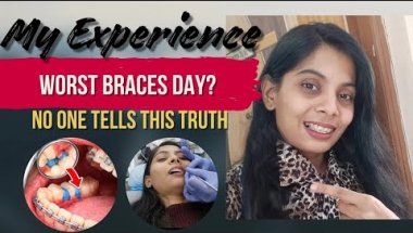 Worst Braces Appointment Yet? 😖 | Day 5 #BracesJourney #BracesDay5 #BracesExperience #DentalCare