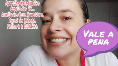 Aparelho Ortodôntico Depois dos 30 Vale a Pena:Cura do Bruxismo,Dores de Cabeça e Melhora a Estética