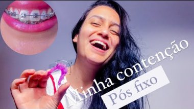 APARELHO MÓVEL| REMOVI O APARELHO FIXO