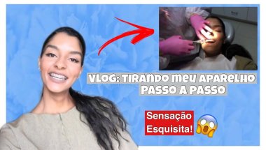 VLOG: Remoção Aparelho Ortodôntico + Super Polimento + Harmonização Dental + Contenção fixa e Móvel