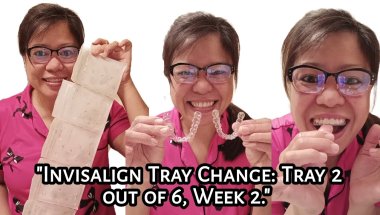 Invisalign Tray Change: Tray 2 out of 6 | Week 2 | Experience | Tagalog