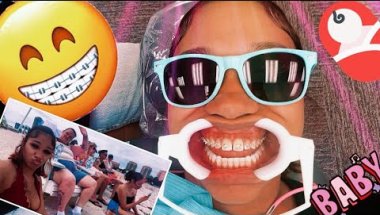 WE FINALLY DID IT 🤩🌟🩵/BRACES/BABYSPRINKLE/BABYGIRL/BRACEFACE/NAVISCELEBRATION