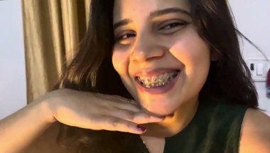 Braces wire muh pe chubbte bhi hai ?#viral #dentist #trending #youtube #smiledesigndental #teeth