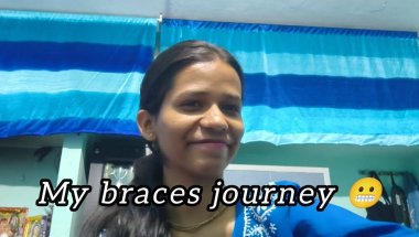 Confused about braces ? Watch this..#bracesjourney #bracestreatment #lifelessons #loveyourself