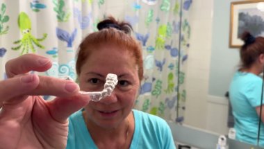 I finally got my Invisalign put in,Let me show you them!