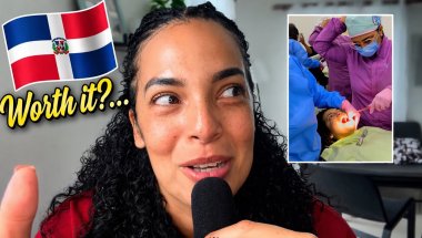 The Truth About Getting Dental Work in the Dominican Republic 🇩🇴 (Cost, Experience, Results)