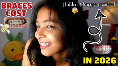 💸🦷😨Braces लगवाने में कुल कितना खर्चा होता है || 2026 Braces Cost Reality (Metal, Ceramic, Aligners)