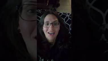 I got braces at 37 years old 😬