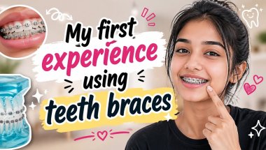 Braces ittappol enikku undaya first shock 😭 #trending