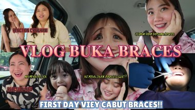 AKU BUKA BRACES!! RASA LAIN MACAMM, MENYESAL??!!