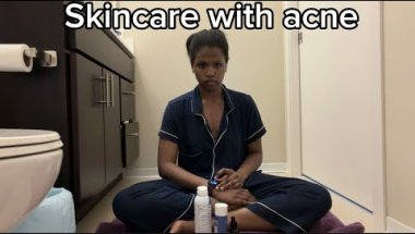 My skincare routine with acne
