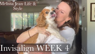Week 4 Invisalign Update | Remind Me Why I’m Doing This?