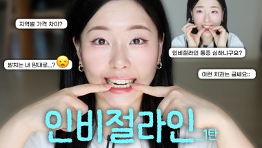 인비절라인 교정 후기 1탄😬✌🏻 | 일단 병원을 무조건 잘 고르기‼️ | 3주차 교정의 신세계,,🙊