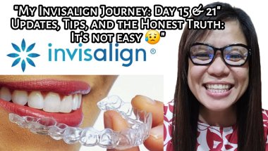 My Invisalign Journey: Day 15 & 21"  Updates, Tips, and the Honest Truth: It's not easy 😥| Tagalog