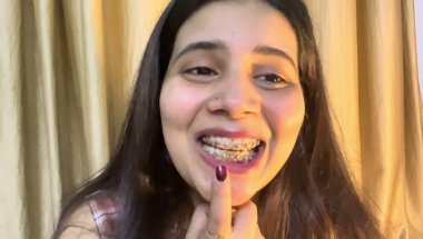 1 year ke braces treatment me kya kya meine face kiya🗣️🥲#viral #dentist #trending #youtube #teeth