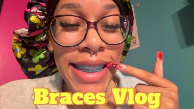 I thought this was the last braces vlog after 10+ years